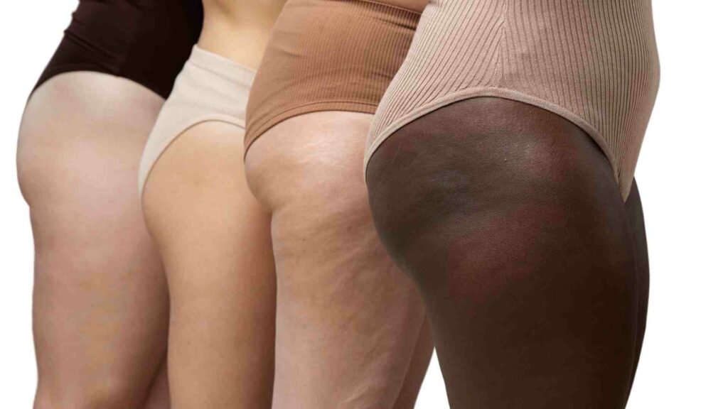 Soin anti-cellulite : les techniques incontournables pour lutter contre la la peau d’orange