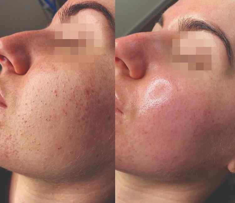 soin Happy Facial