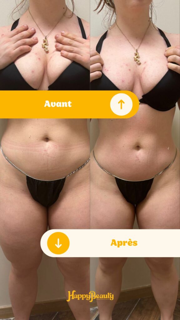 Soins minceur efficaces