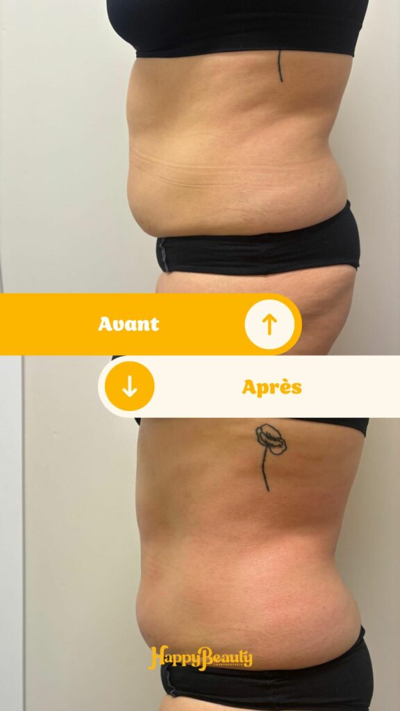Soins minceur efficaces