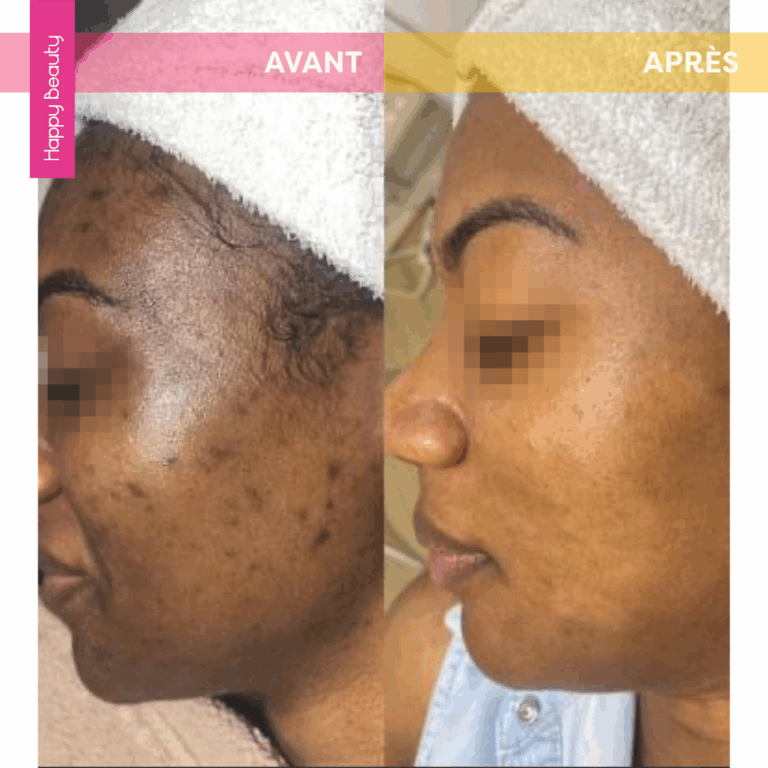Résultats soins visages Happy Beauty