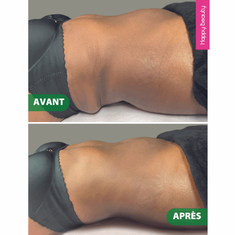 Prestations minceur Happy Beauty