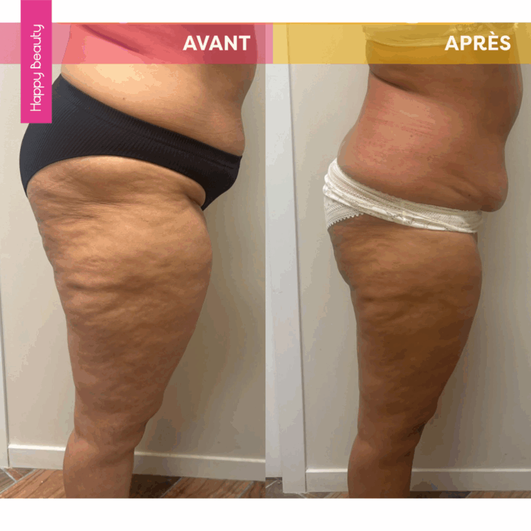 Objectif minceur Happy Beauty