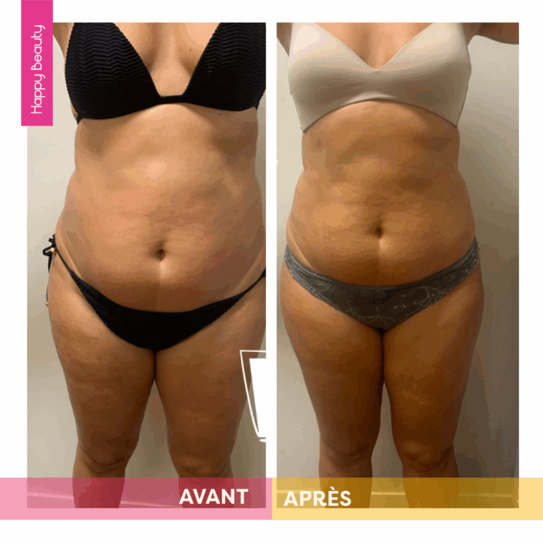 Transformation minceur Happy Beauty